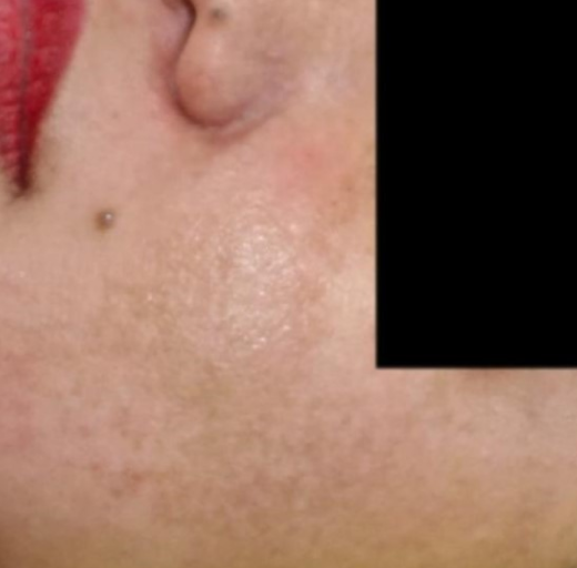 Before/After Image
